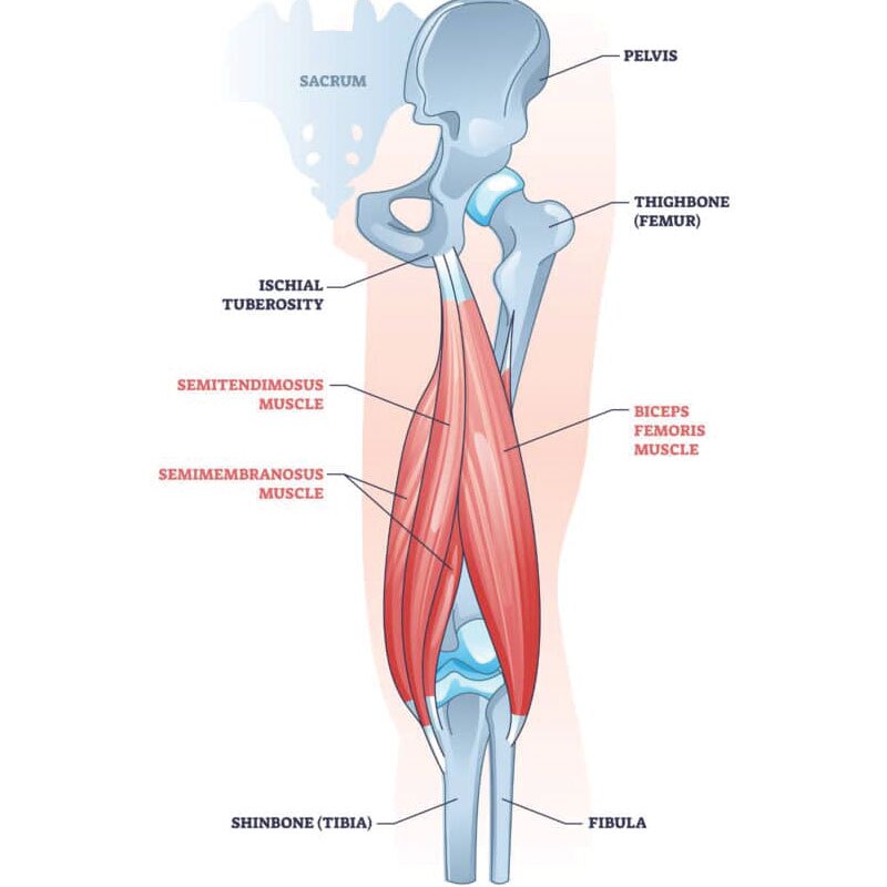 hamstring tendinopathy anatomy