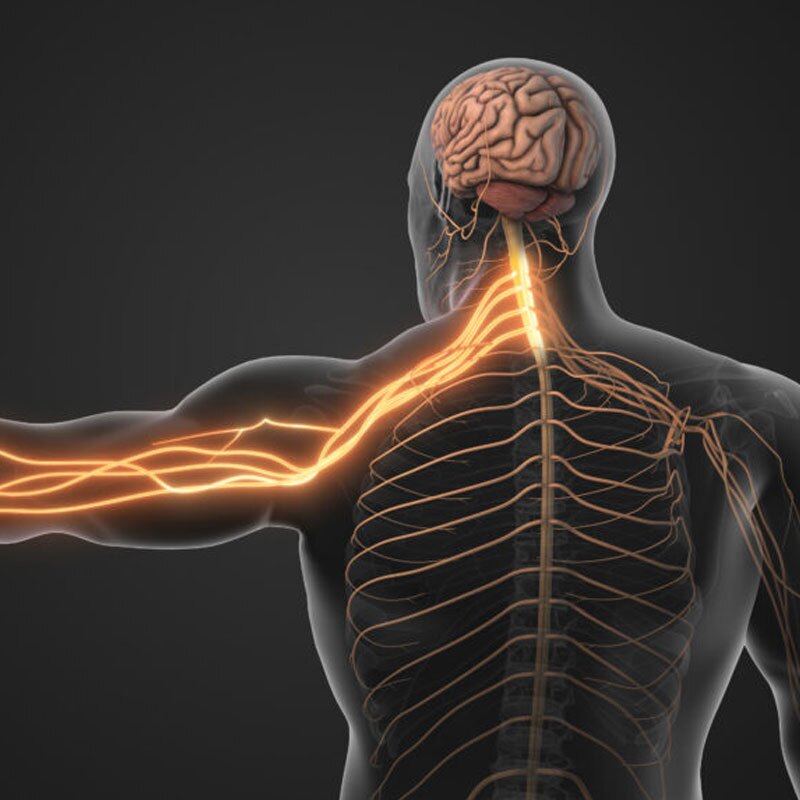 diagram of medial nerve radiculopathy