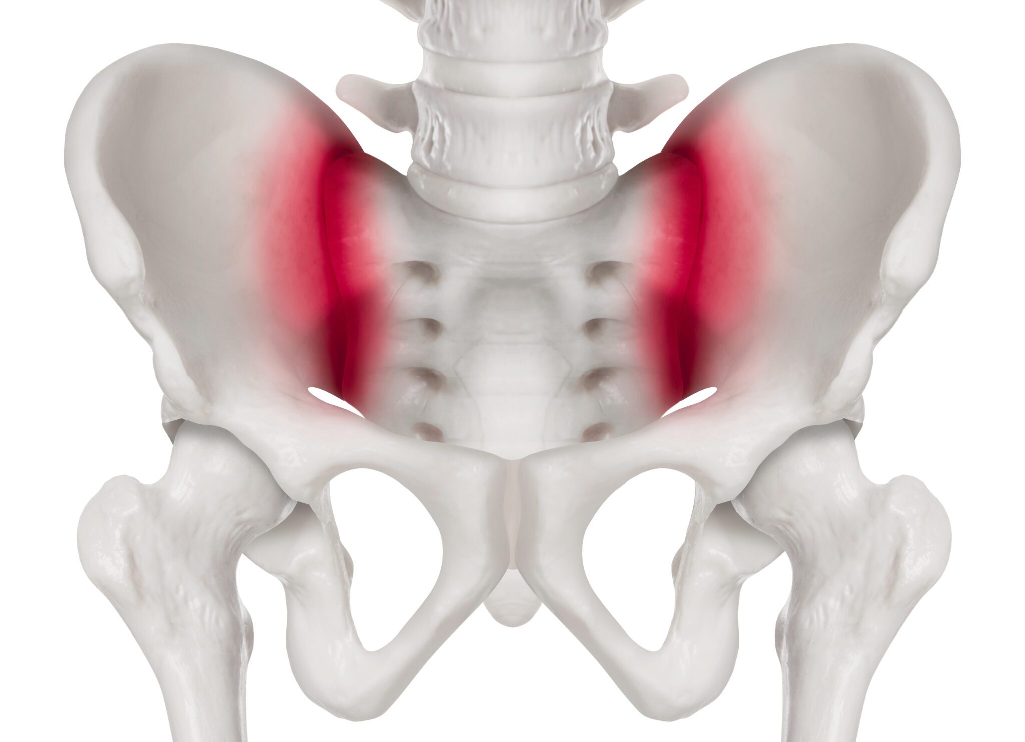 diagram of si joint irritiation
