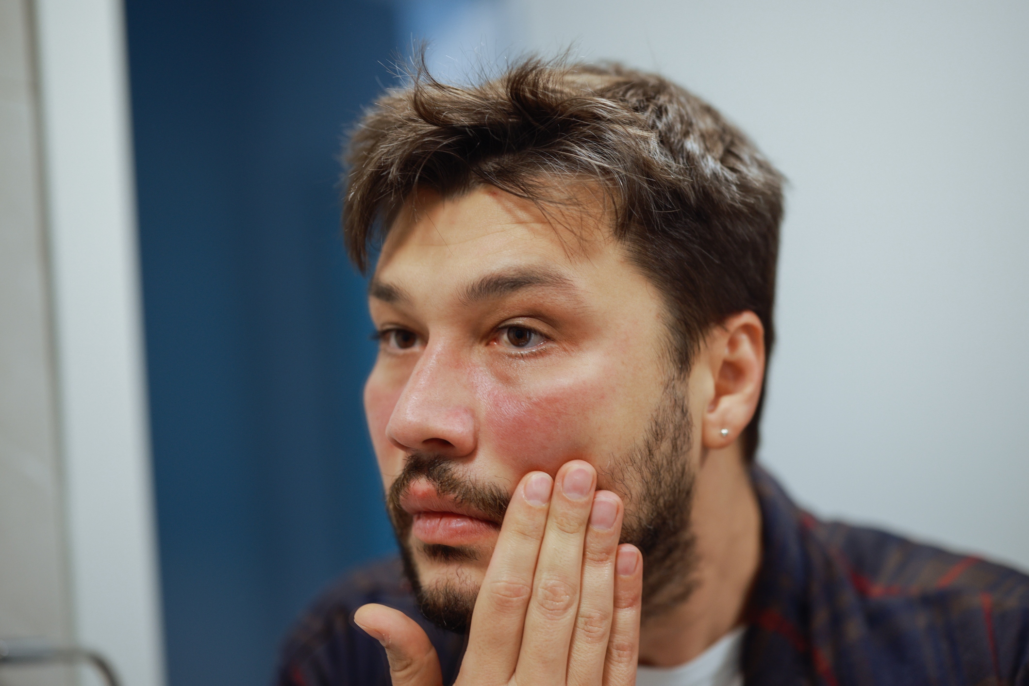 Foods to Avoid with Eczema