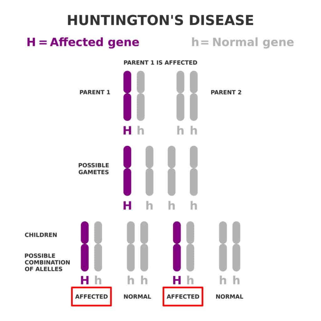 huntington's disease diagram
