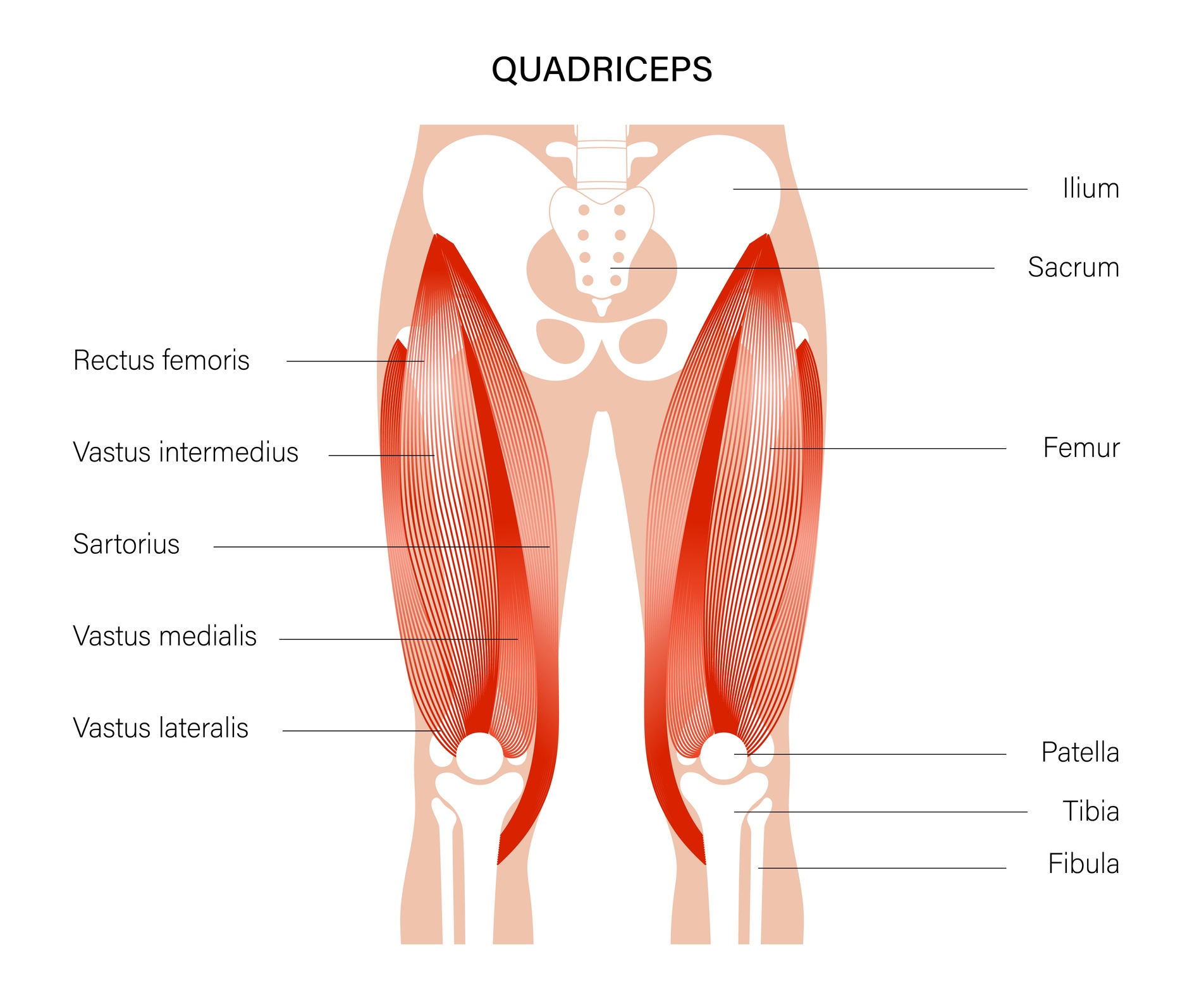 diagram of quad strain