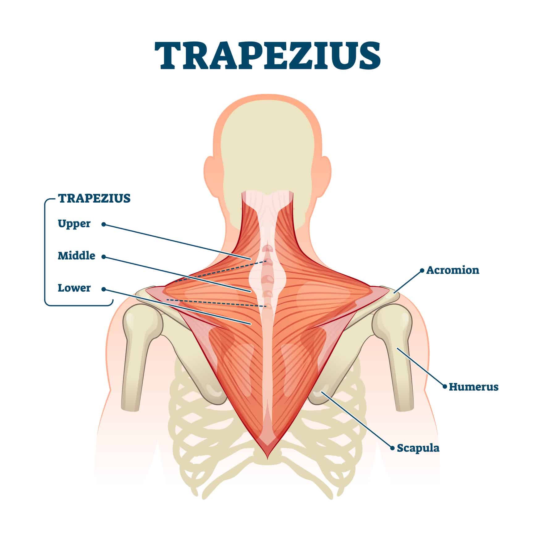 trapezius strain diagram
