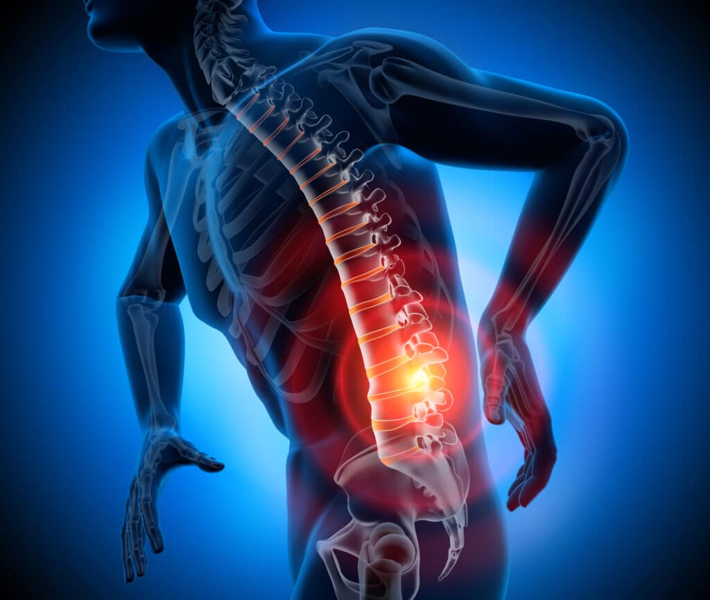 image depicting lower back pain