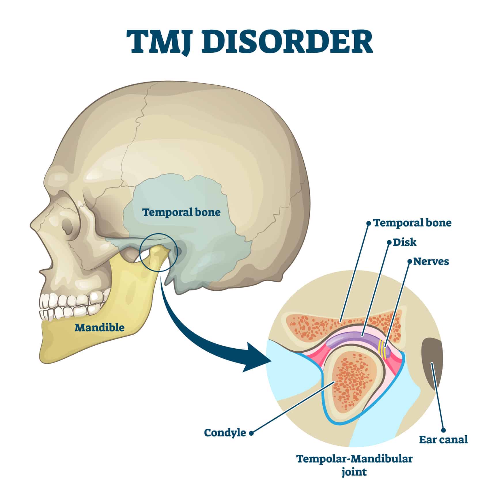 diagram of tmj