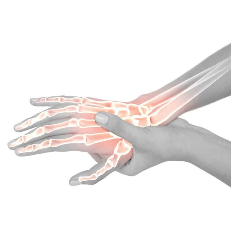 anatomy of dequervain's syndrome