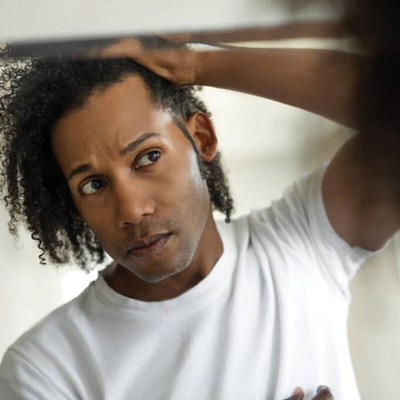 man looking in the mirror at his hair loss