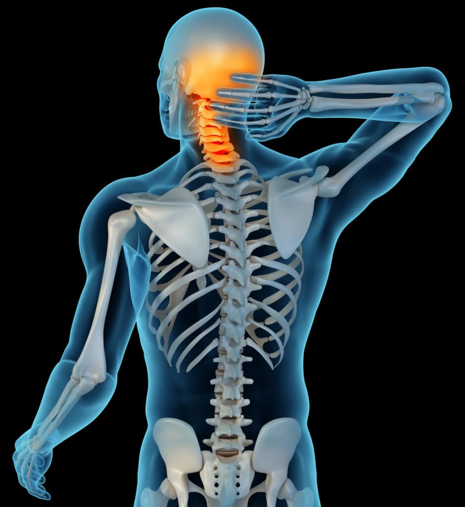 diagram of neck pain