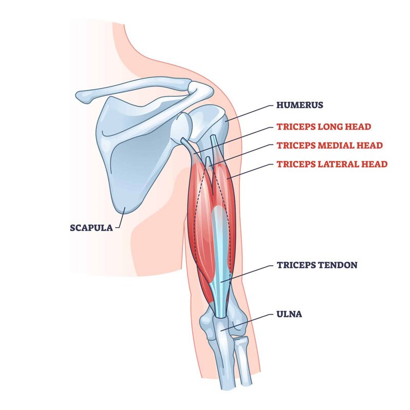 diagram of tricep tendinopathy