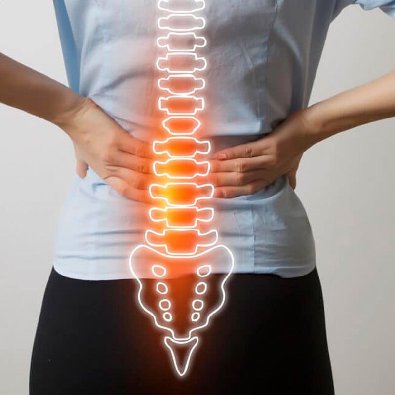 image depicting lumbar radiculopathy pain