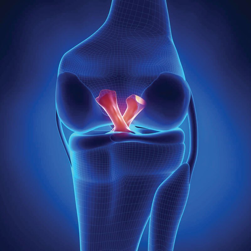 acl sprain diagram