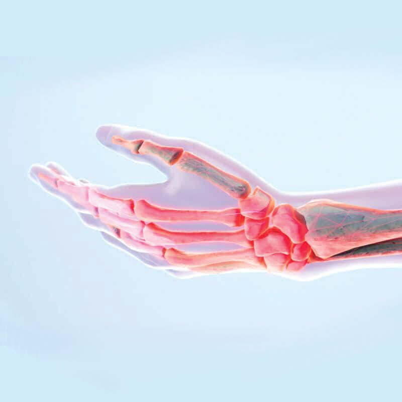 anatomical diagram of hand and finger pain