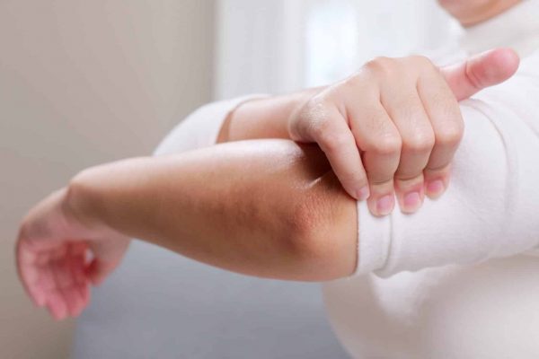 Young woman having pain in her elbow and using hand for self massage to relieve aches and pains.