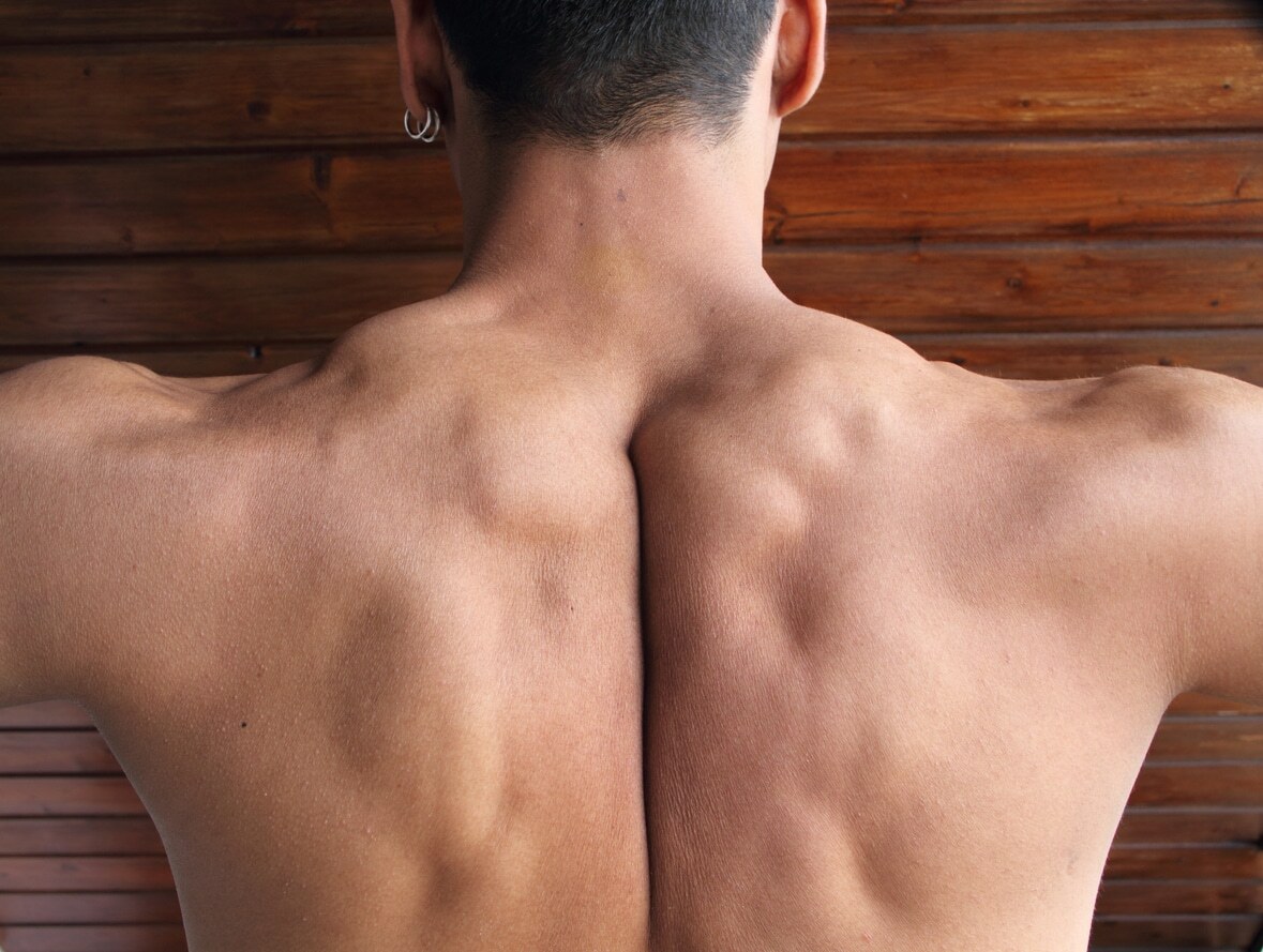How Long Does Trapezius Strain Take to Heal - Trapezius Strain