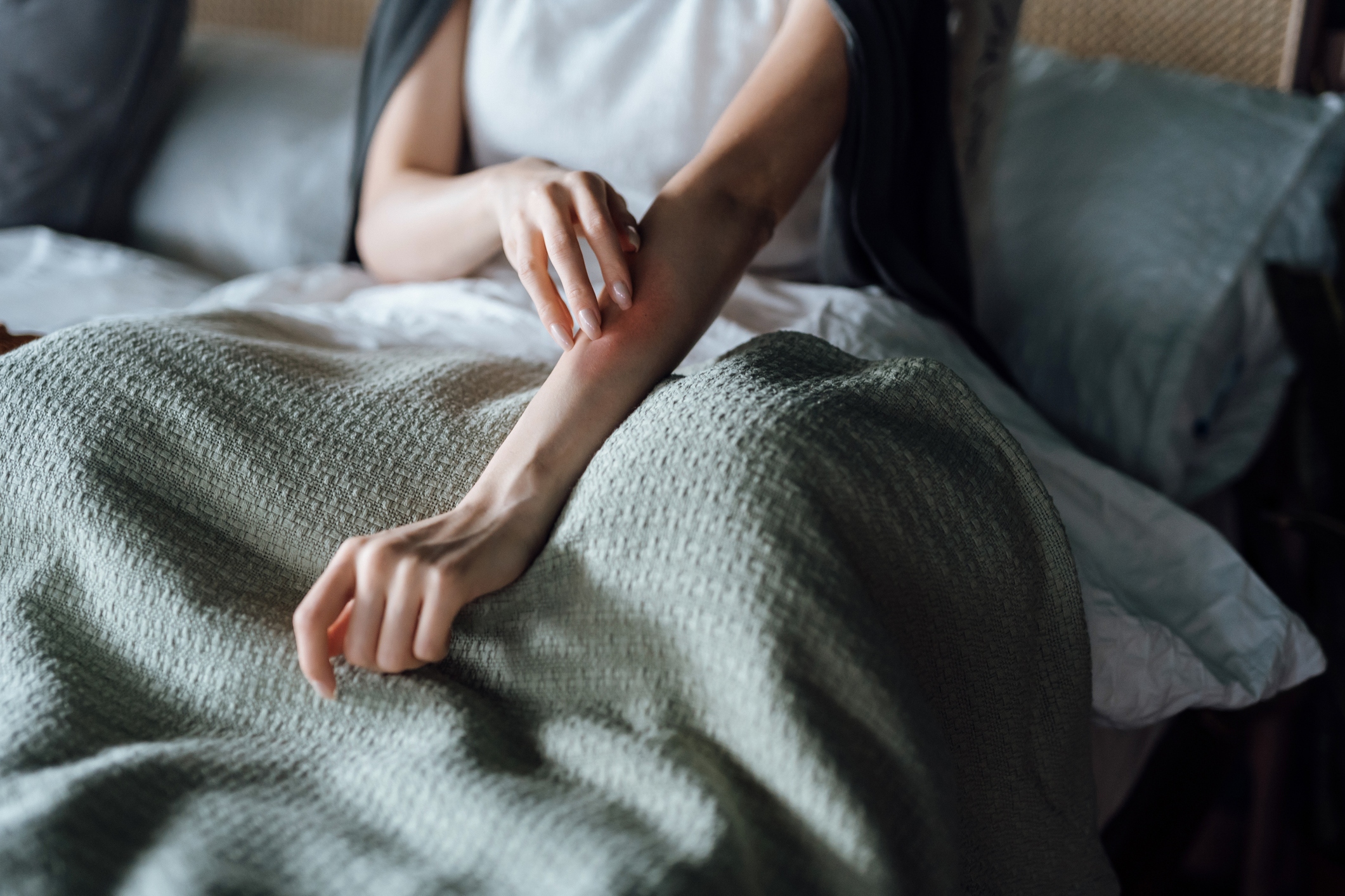 Eczema Symptoms