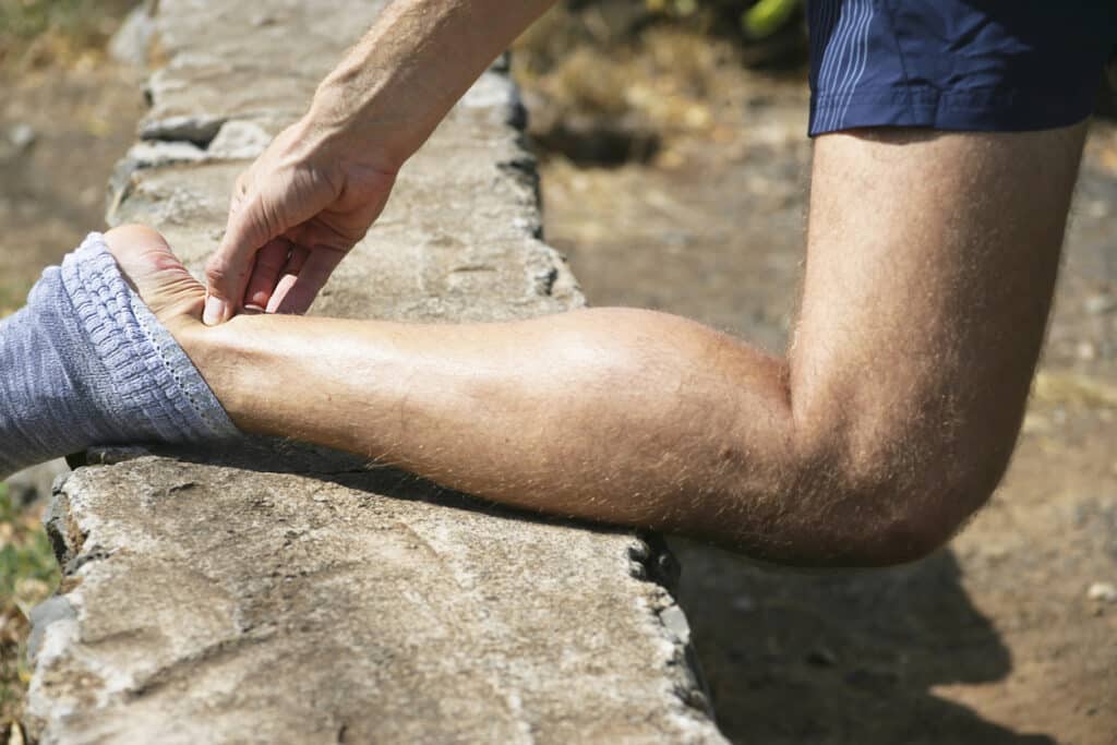When is an Achilles Tendon Rupture Serious?