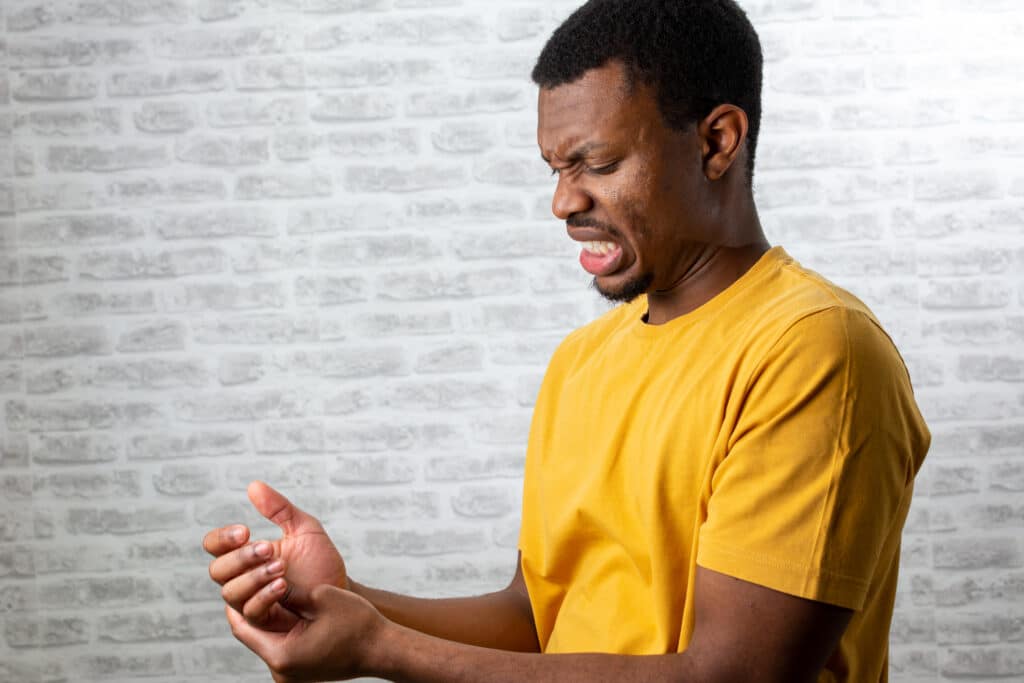 do thumb ucl sprains hurt all the time?