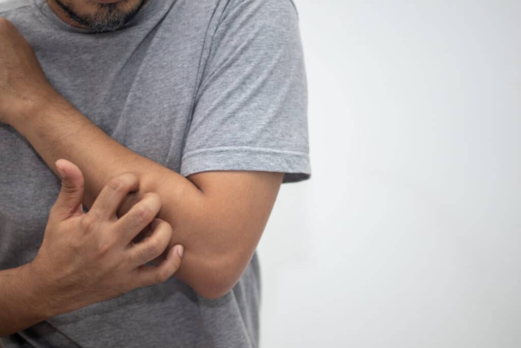 Best Ways to Treat Cubital Tunnel Syndrome