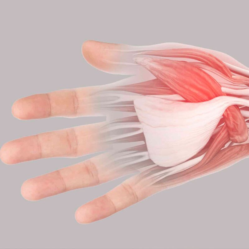 anatomical diagram of thumb strain