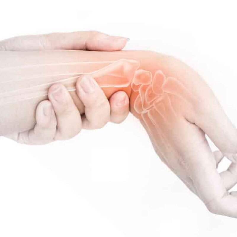 anatomical drawing of a wrist sprain