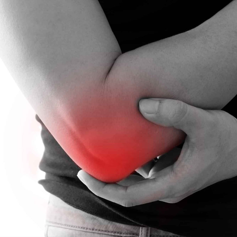 depicting pain from radial tunnel syndrome