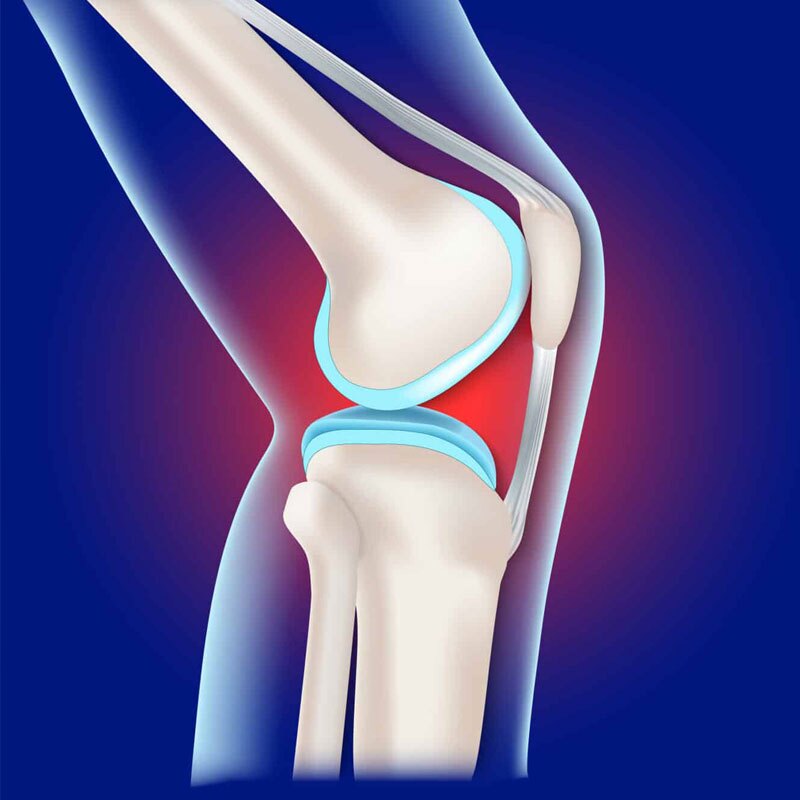 diagram of patellar tendon strain