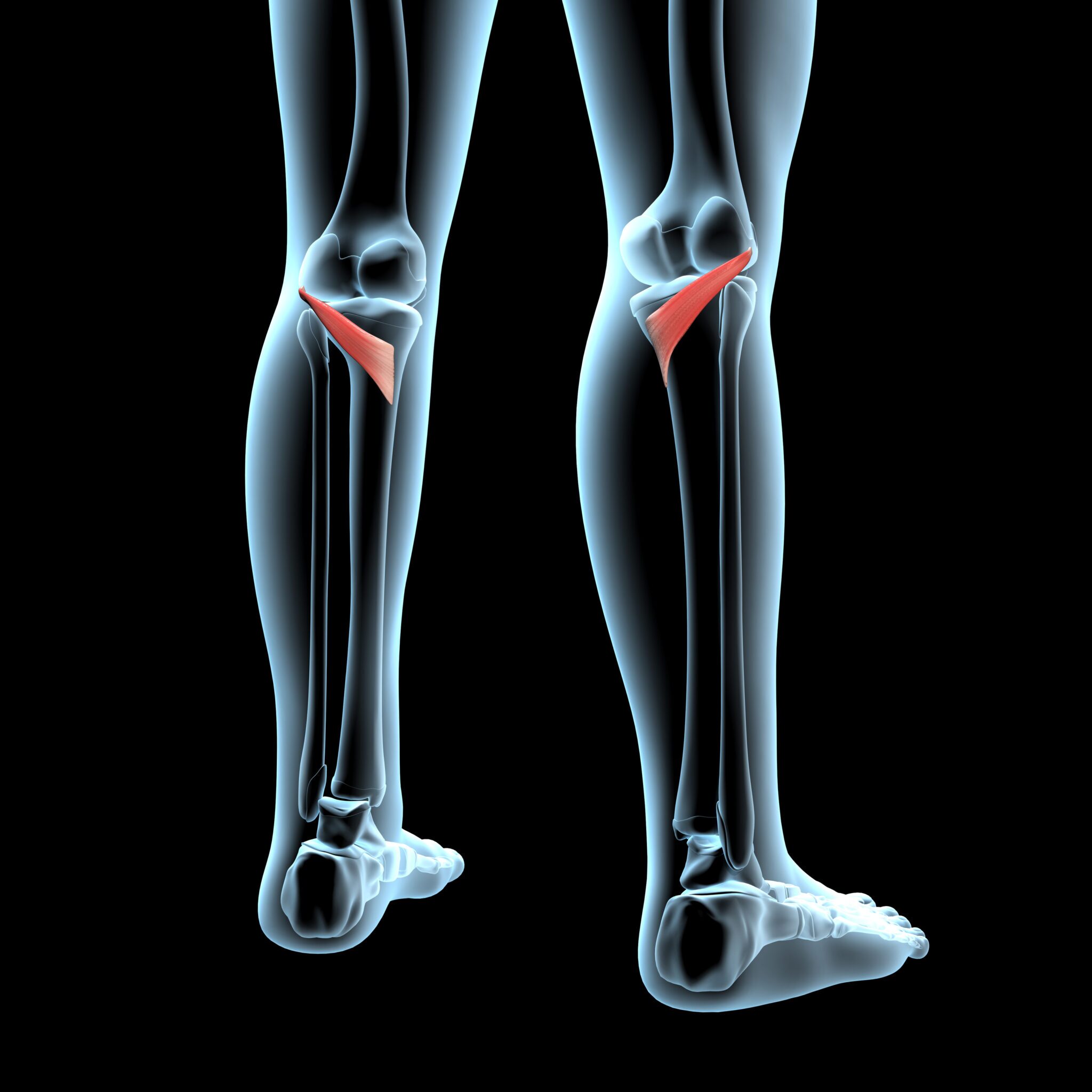 diagram of popliteus strain