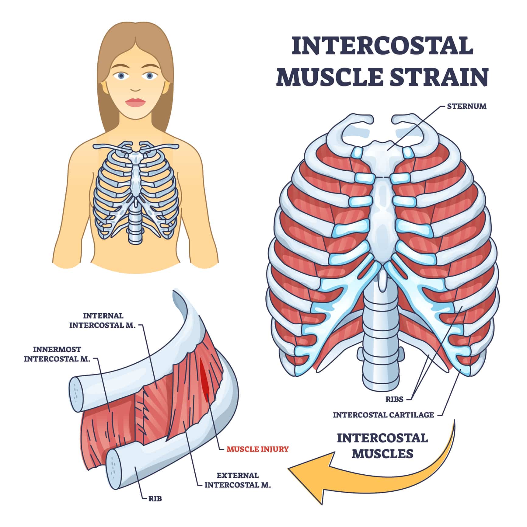 rib strain diagram