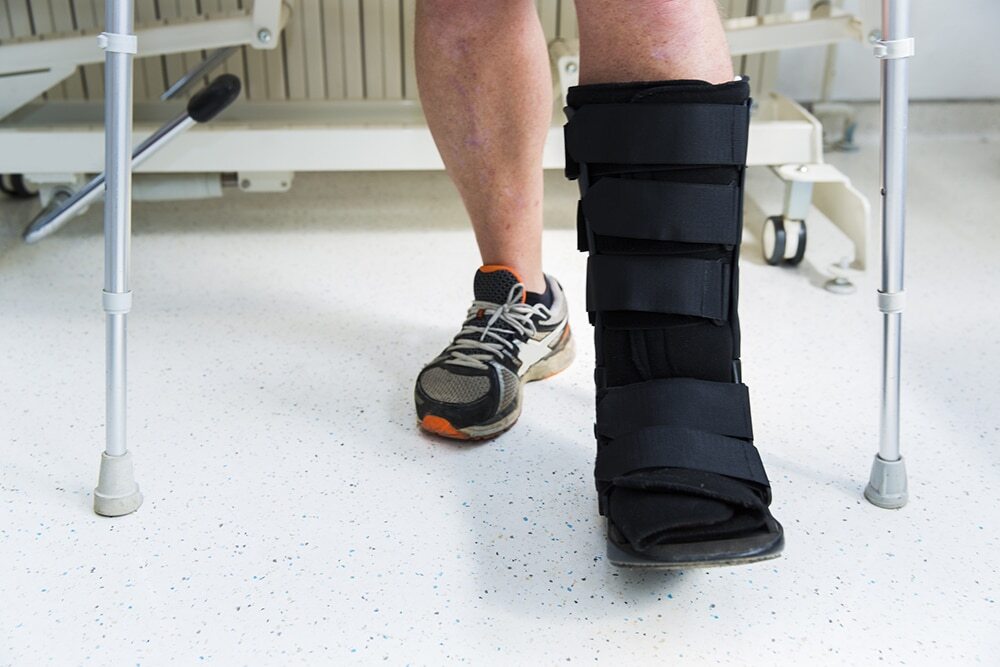 torn achilles tendon treatment