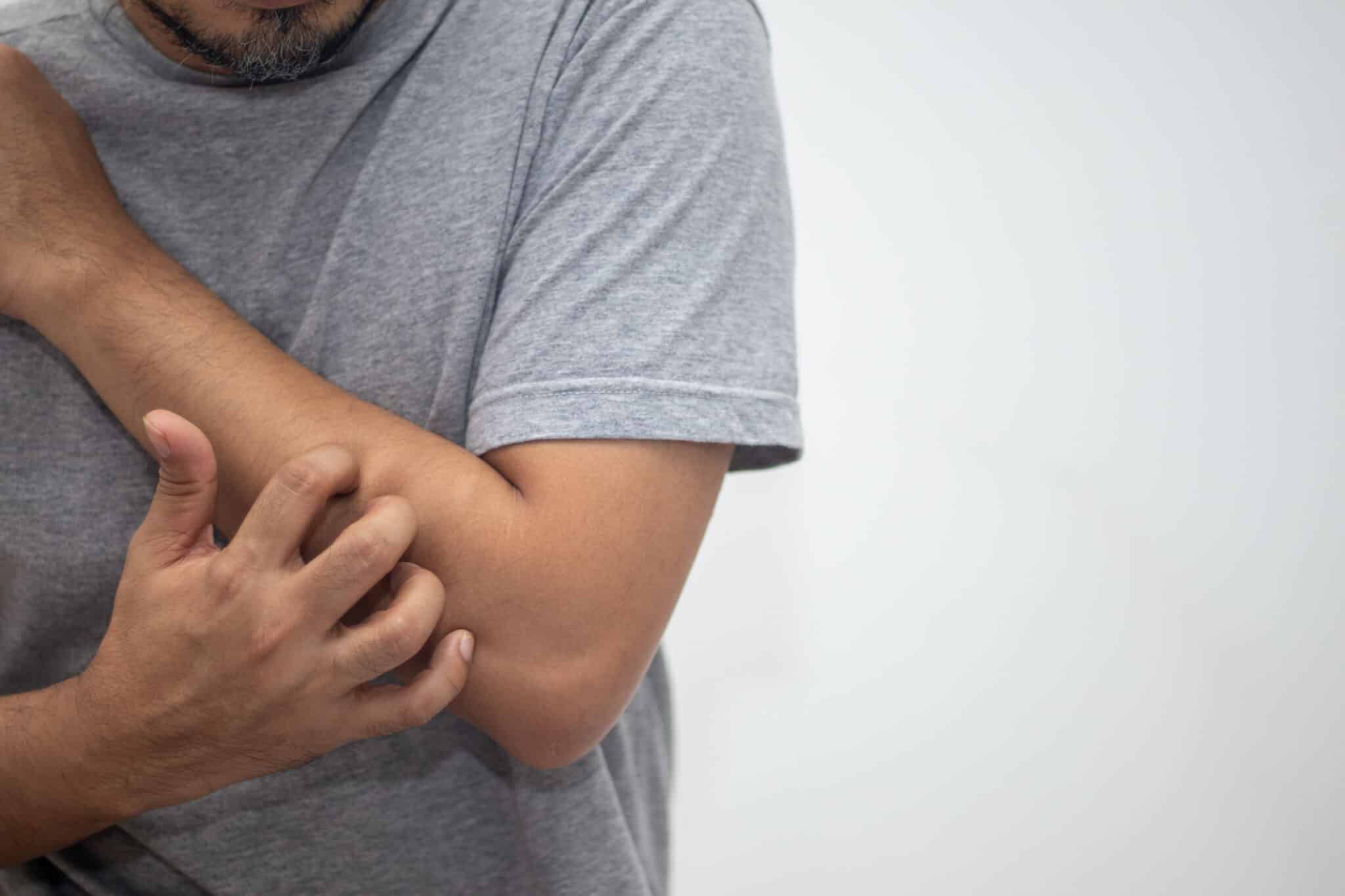 Best Ways to Treat Cubital Tunnel Syndrome
