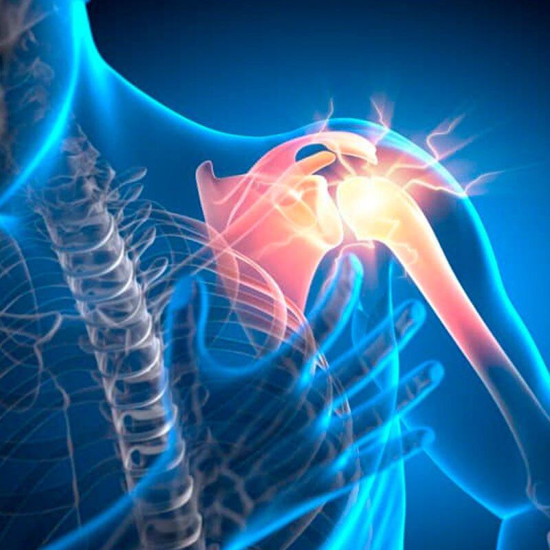 illustration of shoulder pain
