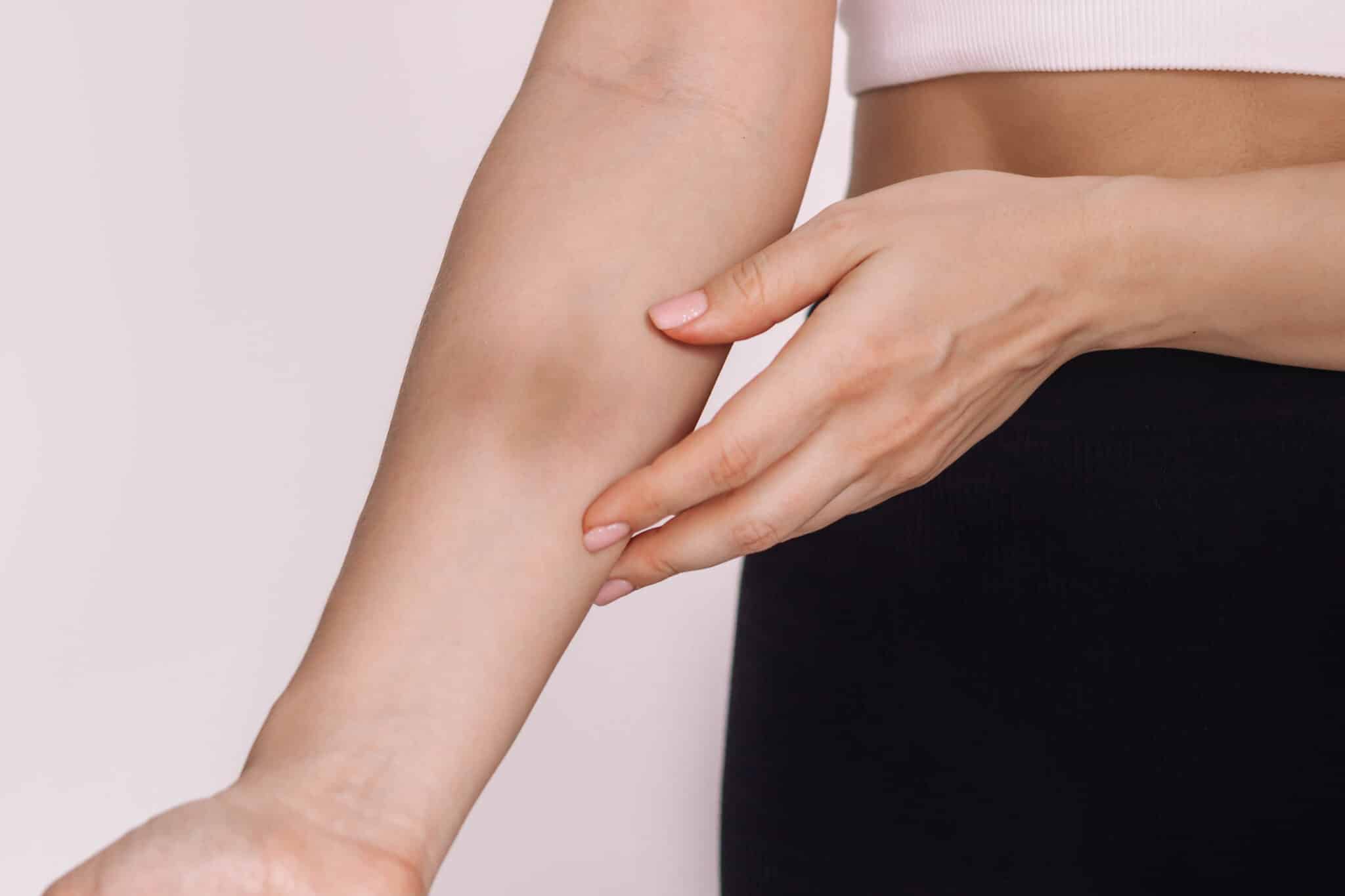 Why are Contusions so Hard to Heal?