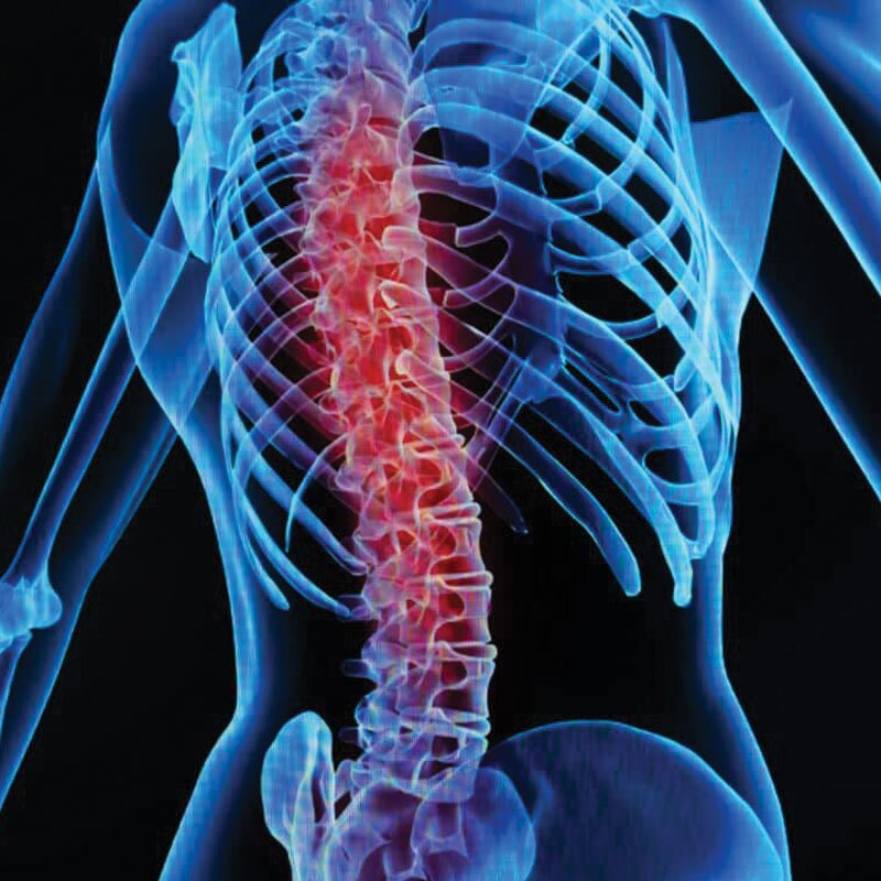 graphic depicting back pain