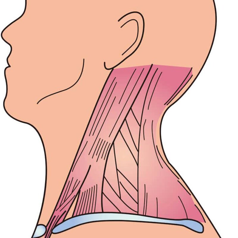 anatomical diagram of a neck strain