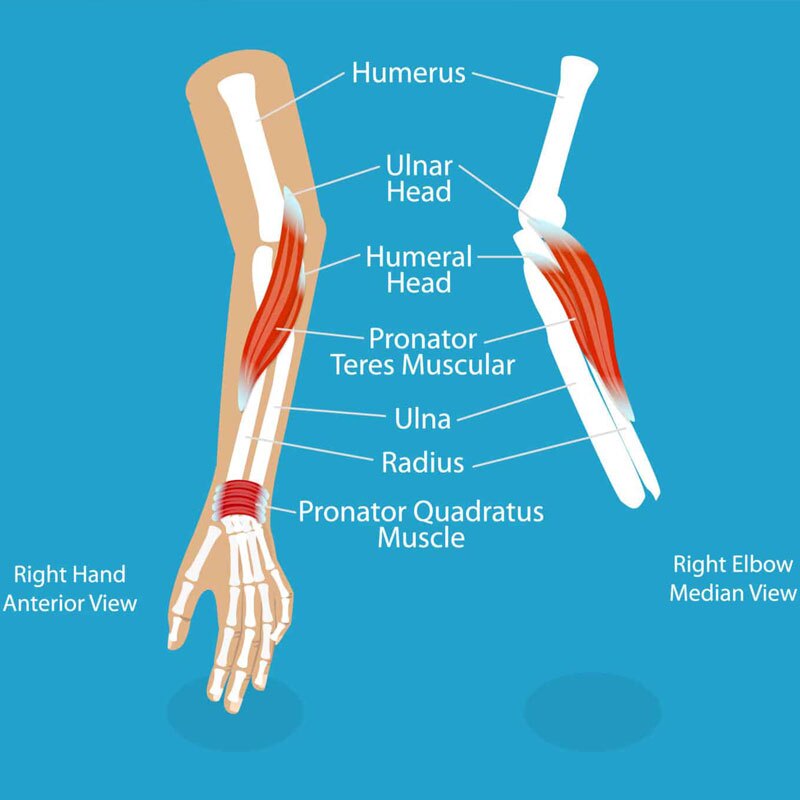 diagram of pronator teres syndrome