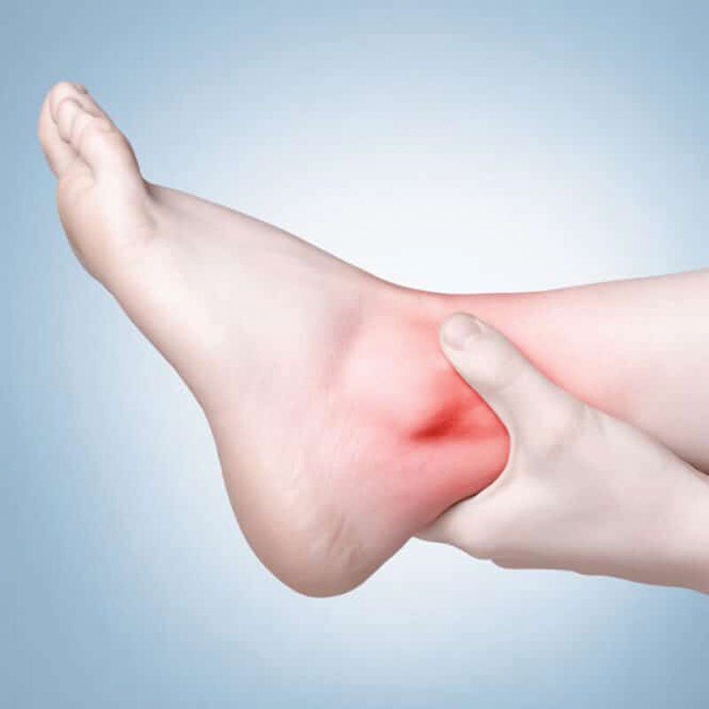 chronic ankle pain diagram
