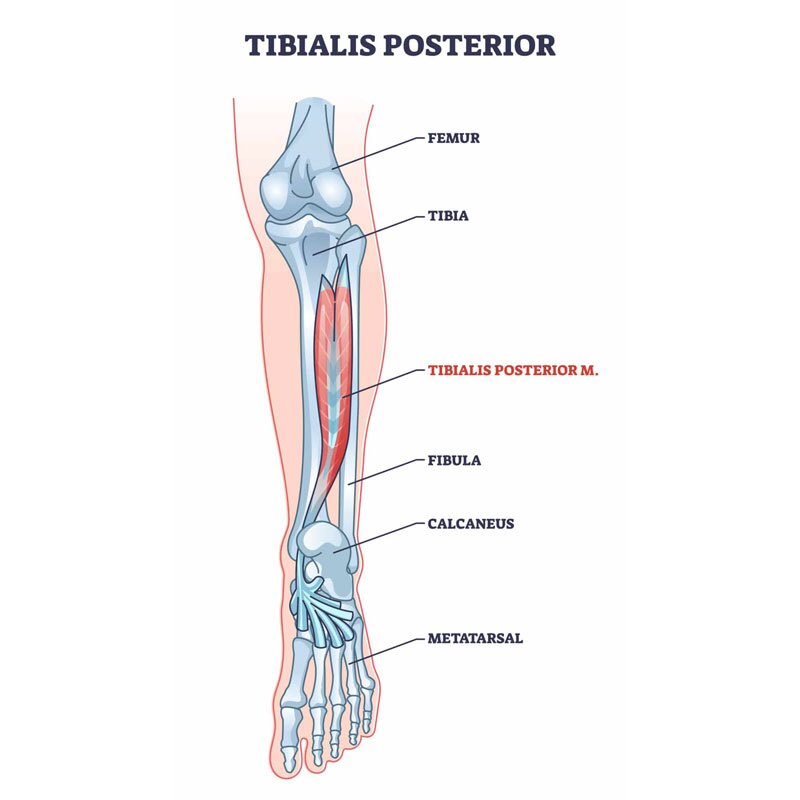 diagram of tibialis posterior tendinopathy