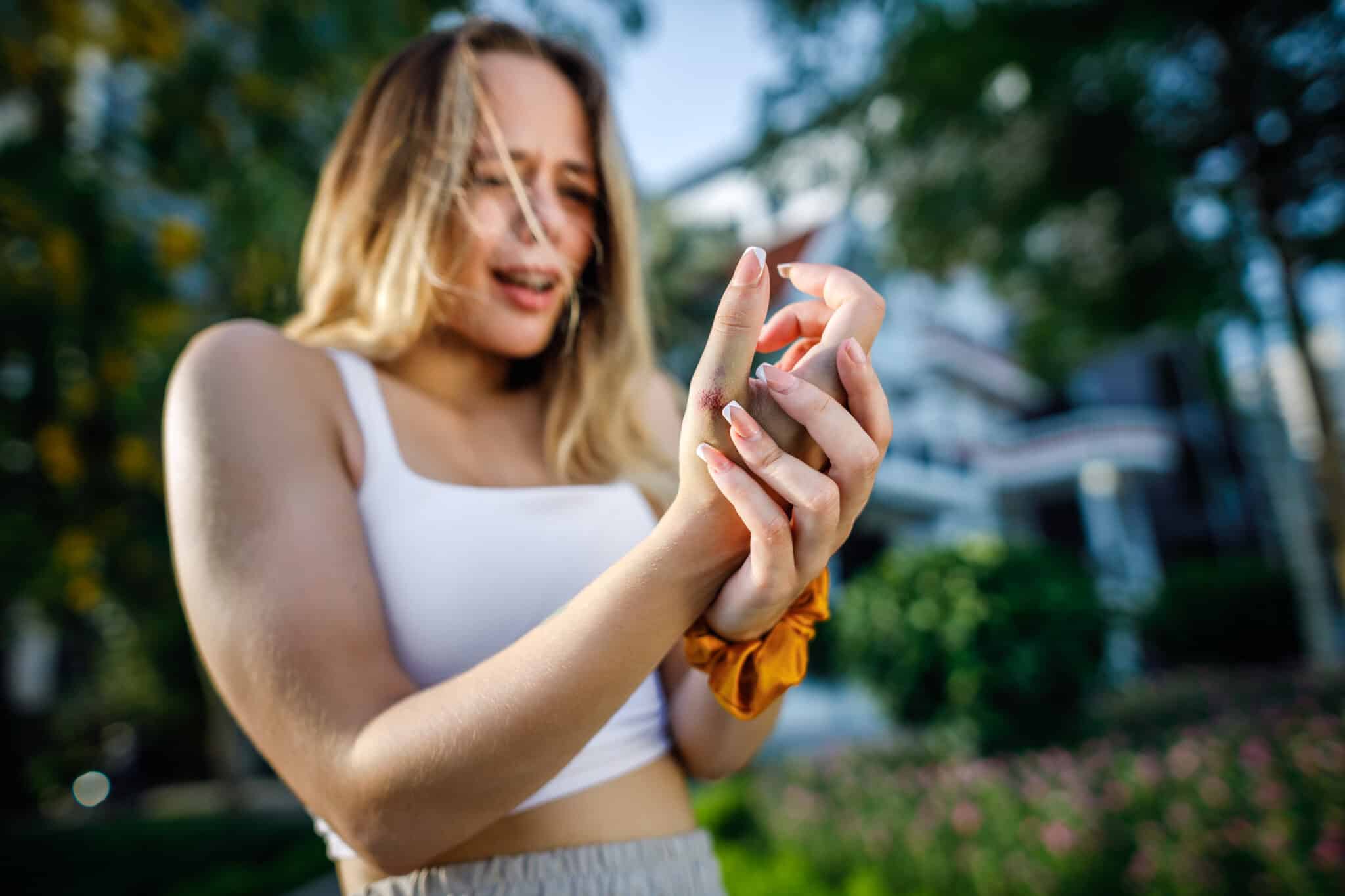 What Triggers Thumb Strains?