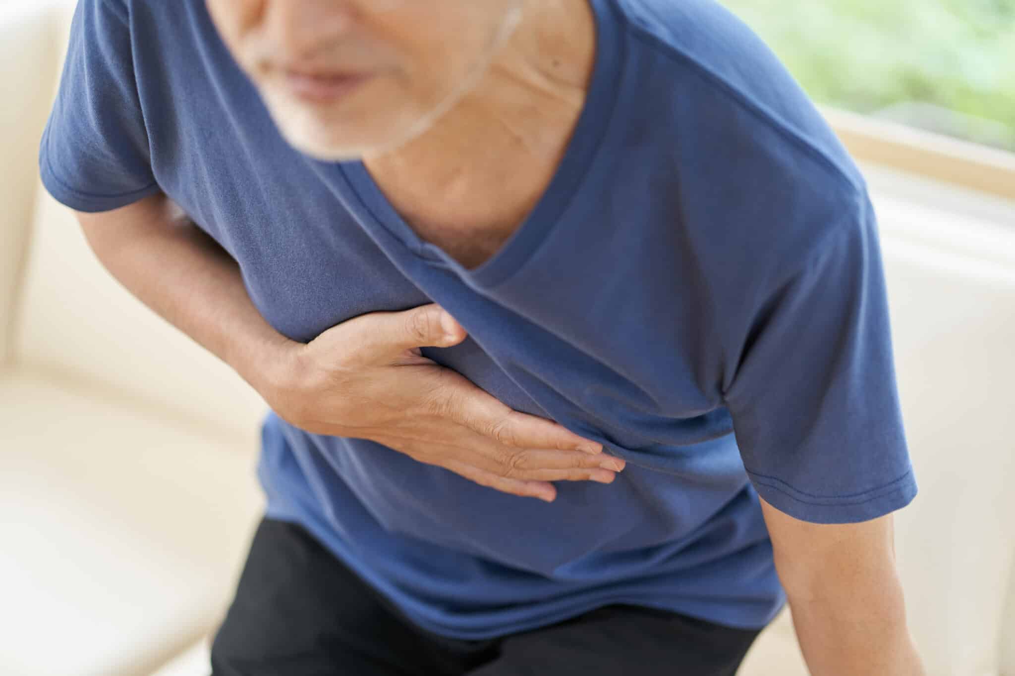 Best Ways to Treat Costochondritis