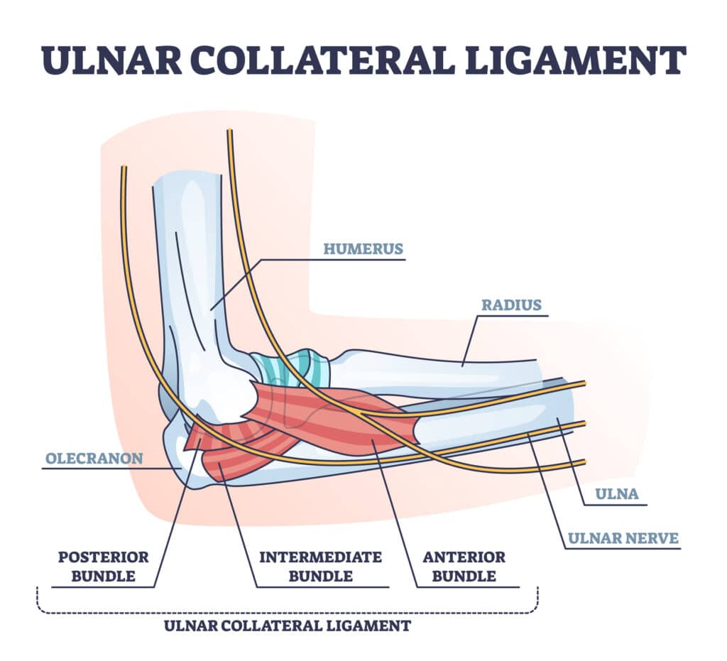 diagram of elbow ucl sprain