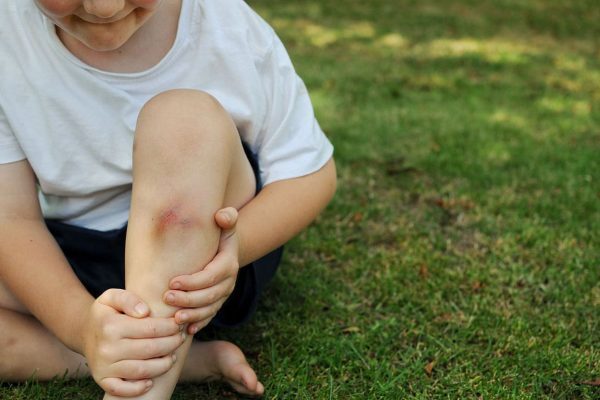 how long do contusions last