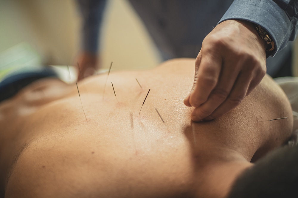 evidence-based acupuncture