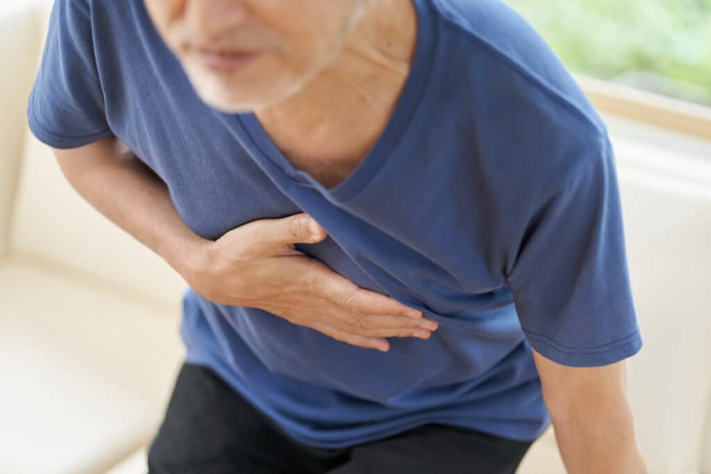 Best Ways to Treat Costochondritis