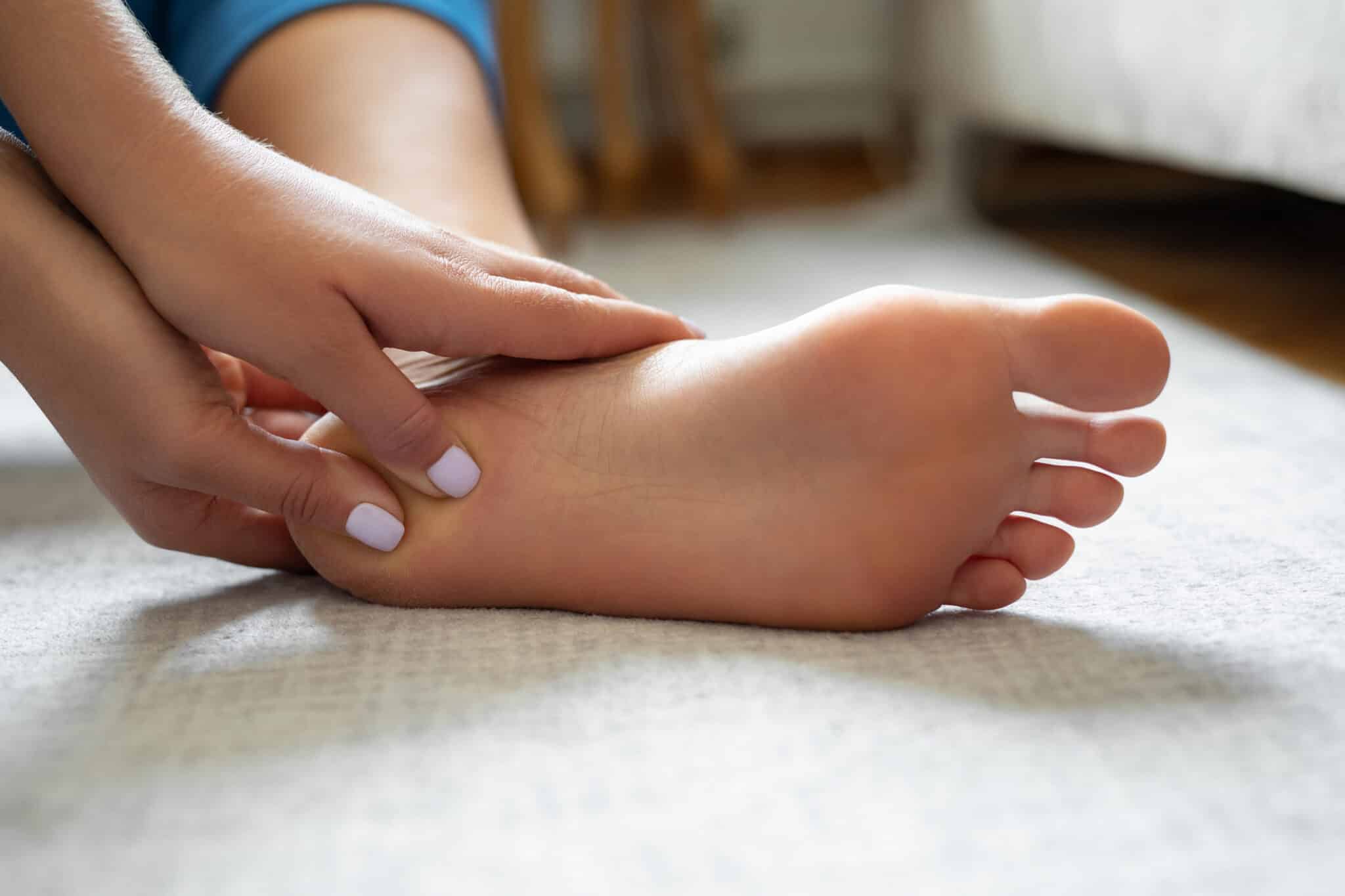 Foods to Avoid With Plantar Fascia Strain