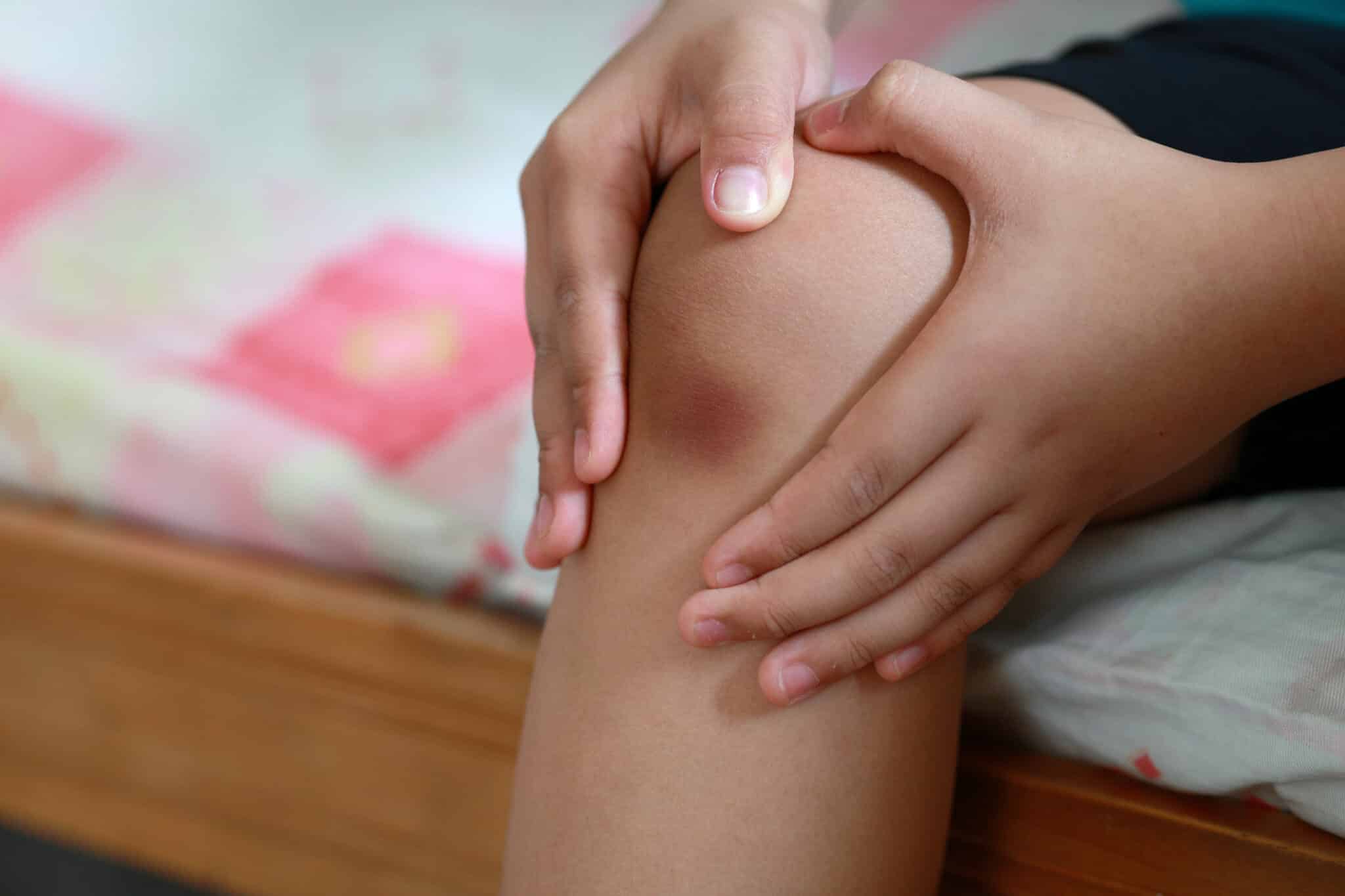 Will You Have Constusions for the Rest of Your Life?