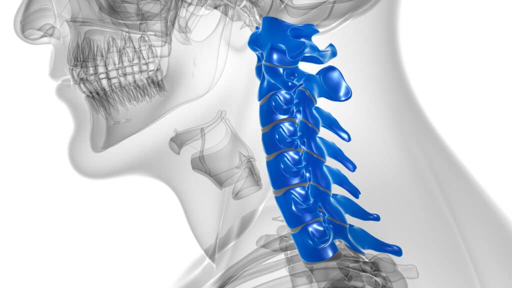Cervical Stenosis Anatomy
