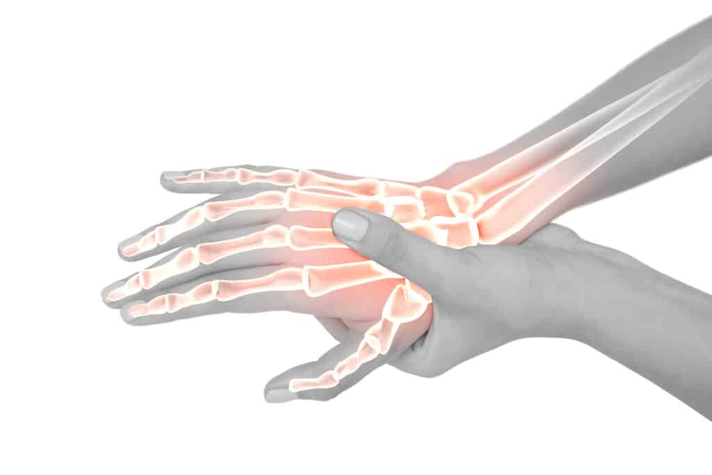 DeQuervain’s Syndrome Anatomy