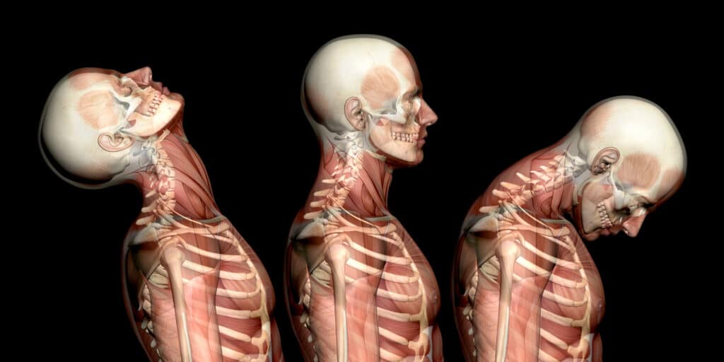 Whiplash Anatomy