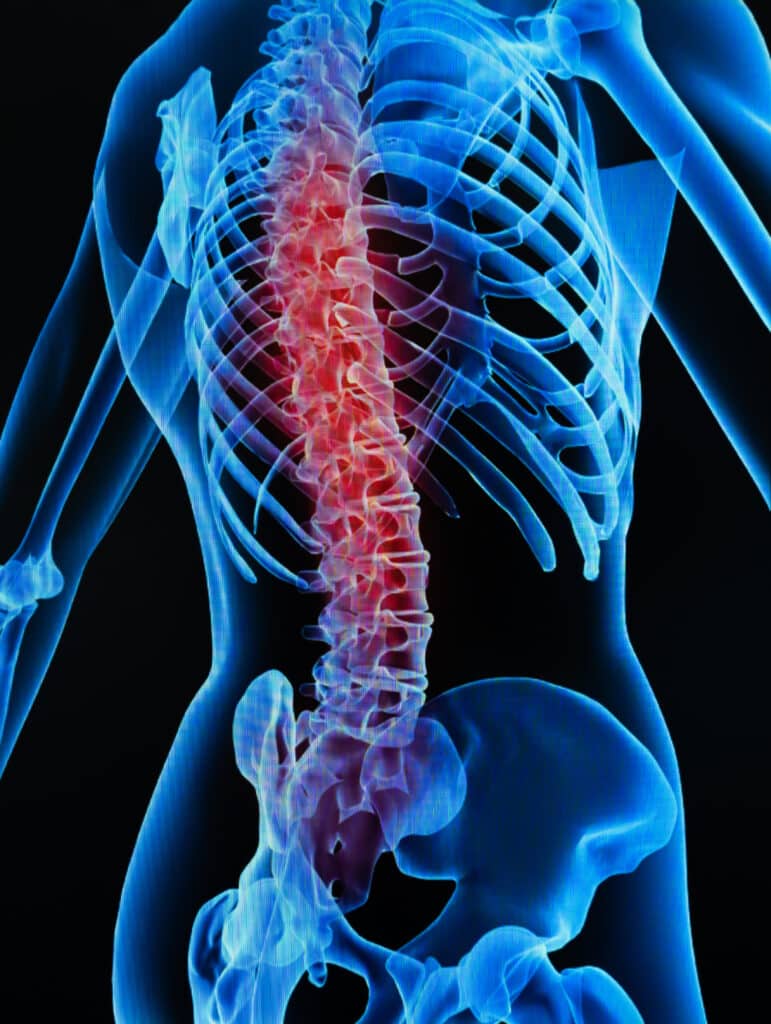 Back Pain Anatomy