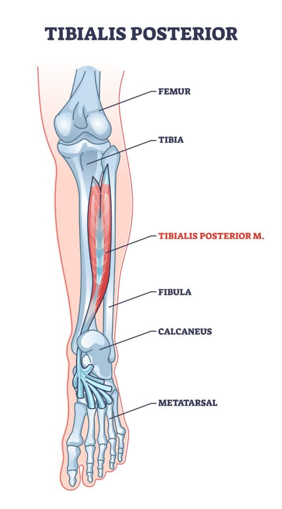 Tibialis Posterior Tendinopathy Anatomy